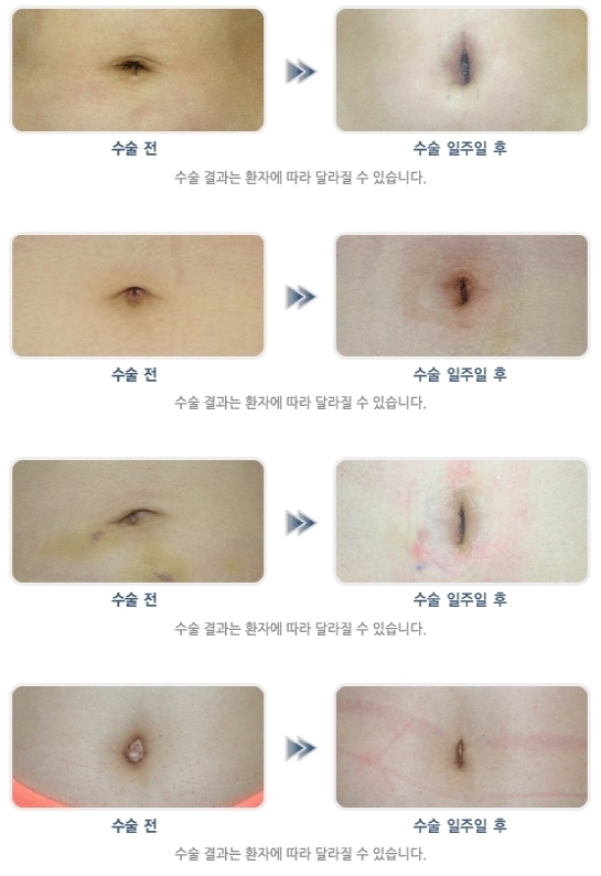 이미지명