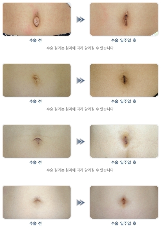 이미지명