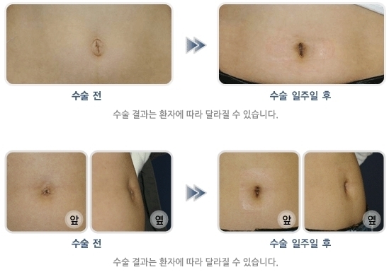 이미지명